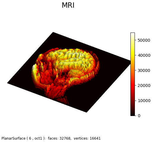 picdemo_MRI_3D
